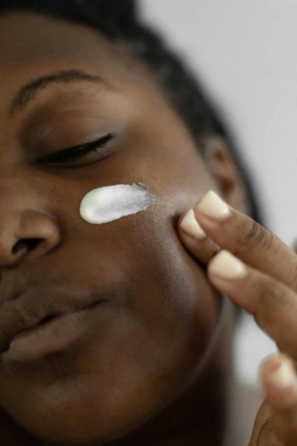 Acne Care